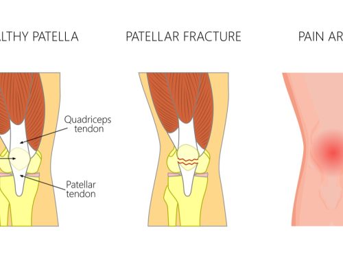 best knee fracture doctor in chhindwara